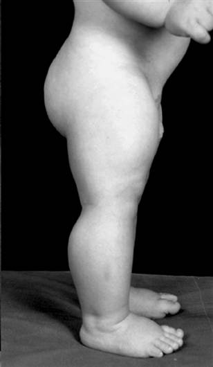 040623_mutatedmuscle_vmed.grid-4x2.jpg